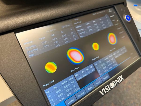 Rodenstock DNEye Scanner 2+ PLUS – Bild 4